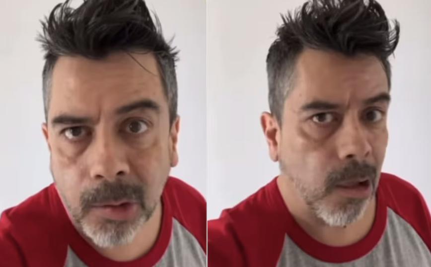 CARLOS ESPEJEL “CHIQUIDRÀCULA” REAPARECE CON PARÁLISIS FACIAL A CAUSA DEL ESTRÉS